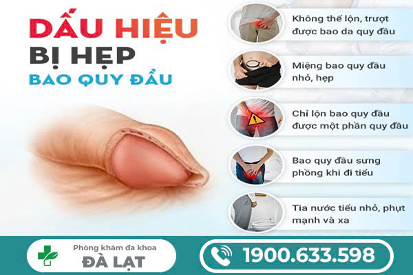 Hình ảnh minh họa